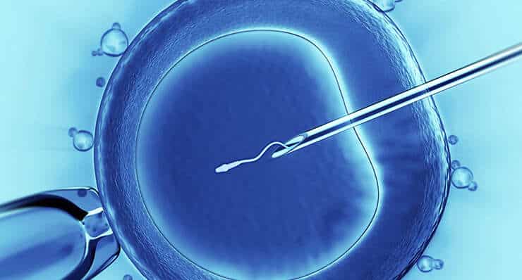 IVF (In-vitro Fertilization)