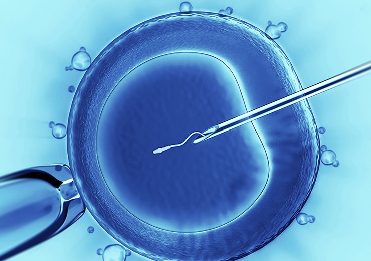 IVF (In-vitro Fertilization)